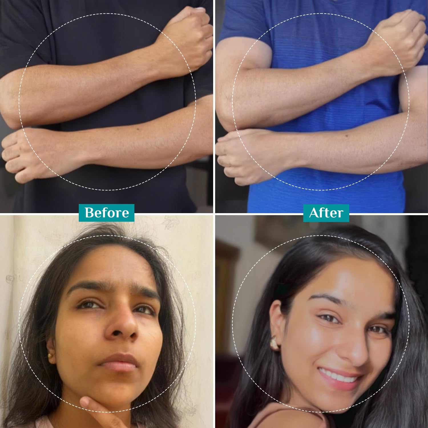 Pilgrim 25% AHA + 2% BHA + 5% PHA Peeling Solution 30ml For Face & Body |10-Minute Facial At Home|Gentle Exfoliating Serum for Tan Removal |For Glowing Skin, Even Skin Tone, Pore Cleansing |Men, Women - Image 2